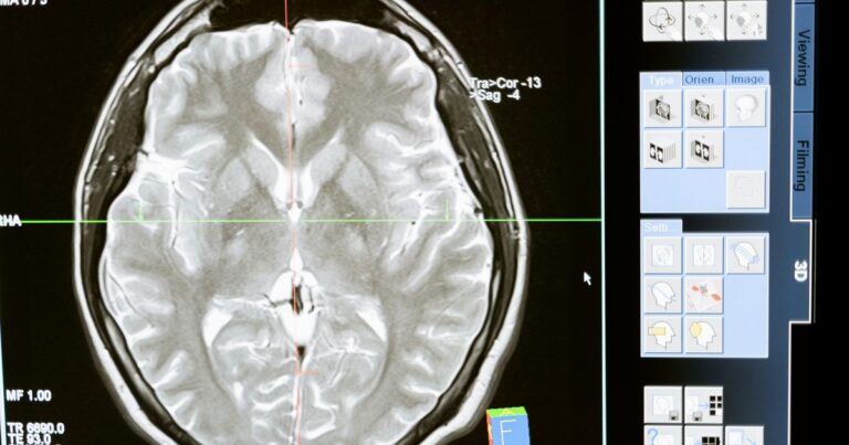 B.Sc in NeuroScience Fees 2026: Cost, Eligibility & Value