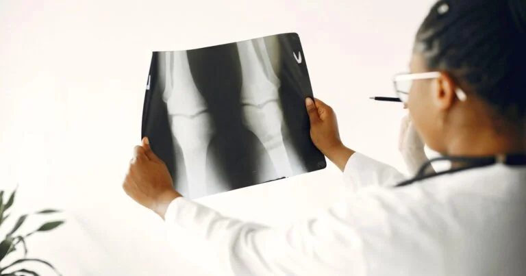 Doctorate of Medicine in Radiology Fees in India 2026